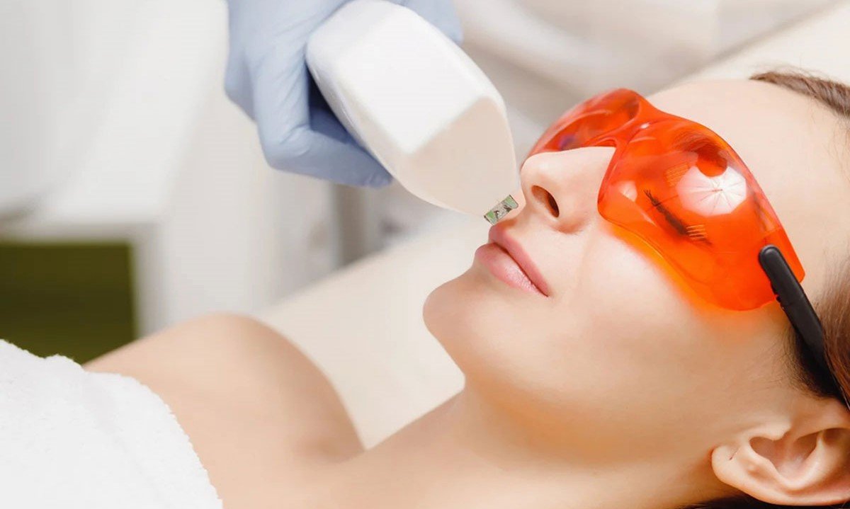 لیزر موی زائد با دستگاه الکساندرایت دایود