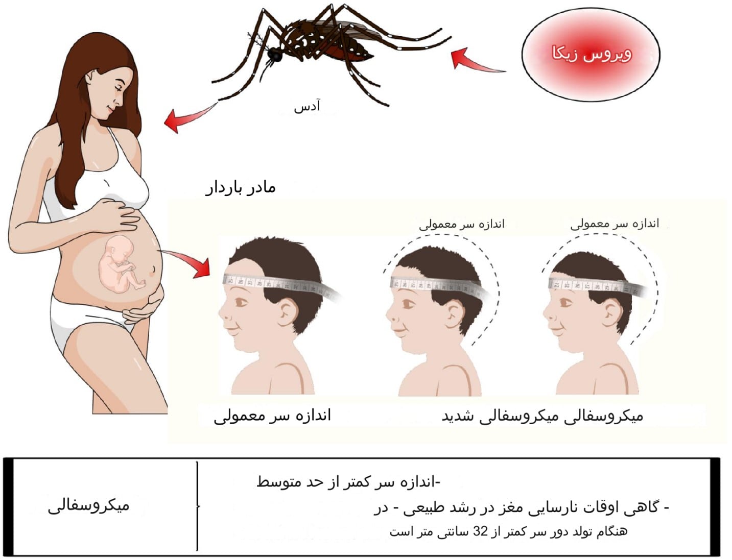 عوارض ویروس زیکا در بارداری