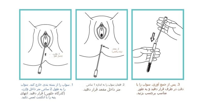 نحوه انجام تست GBS در بارداری