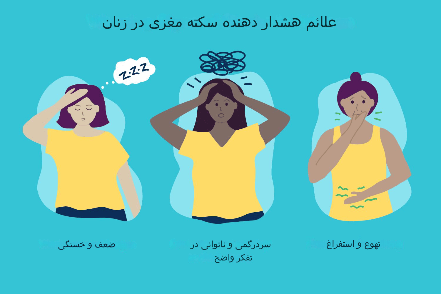 سکته مغزی در زنان