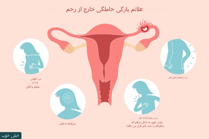 در صورت پارگی لوله رحمی چه علائمی ایجاد می شود؟
