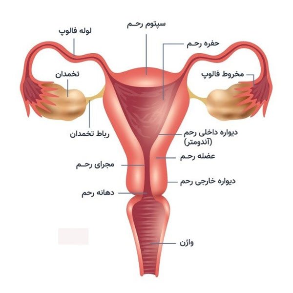 اندومتریوزیس
