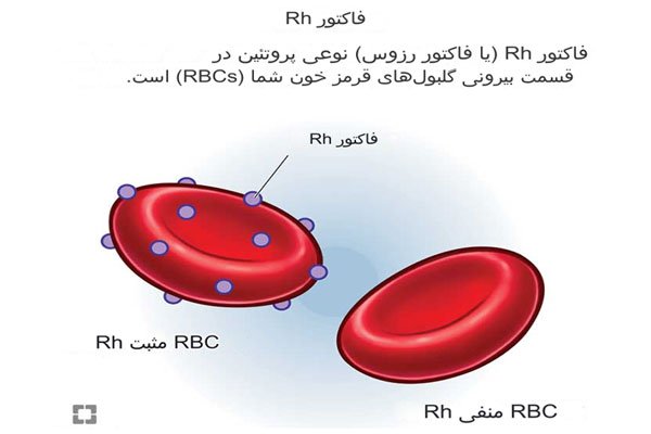 فاکتور Rh پروتئینی است که در سطح گلبول های قرمز یافت می شود