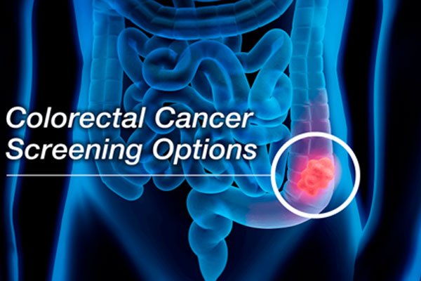 غربالگری کانسر کولورکتال