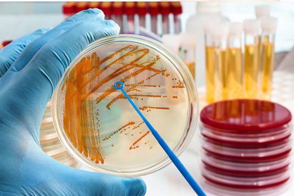 کشت ادرار چیست