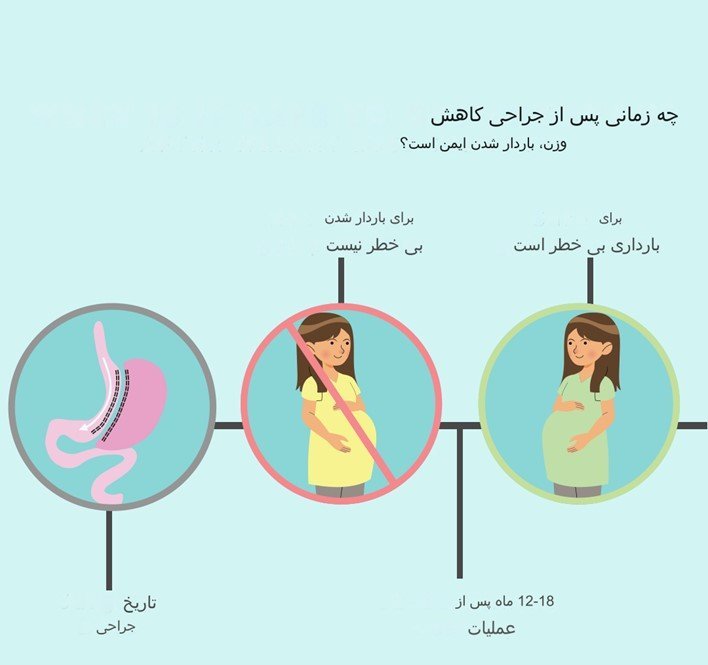 آیا جراحی برای کمک به کاهش وزن قبل از بارداری وجود دارد