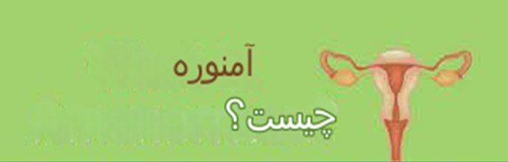 آمنوره چیست