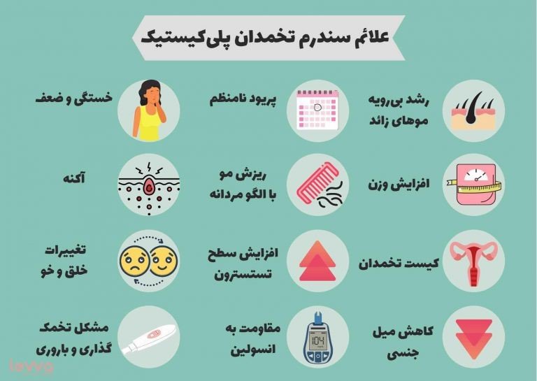 علائم تخمدان پلی کیستیک