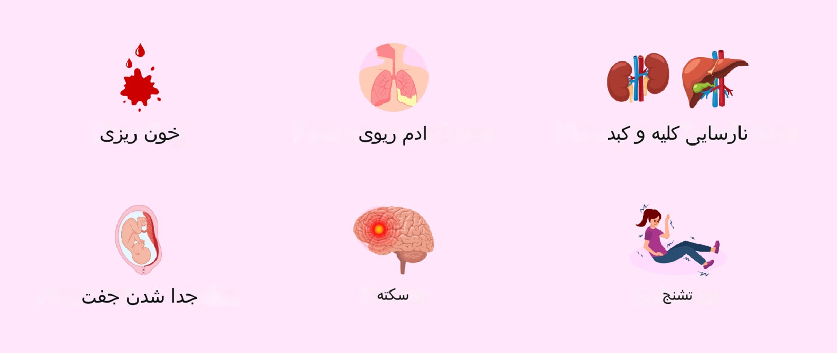  پره اکلامپسی می تواند باعث سندم هلپ شود