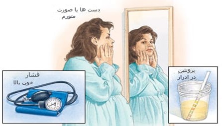 علائم پره اکلامپسی ذکر شده از سمت بیمار