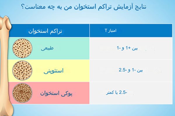 تست اسکن تراکم استخوان