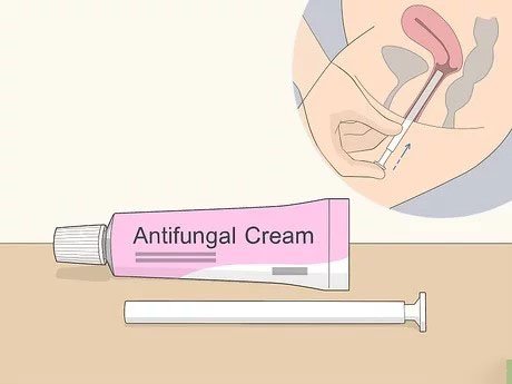 کرم واژینال ضد قارچ